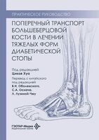Поперечный транспорт большеберцовой кости в лечении тяжелых форм диабетической стопы. Практическое руководство